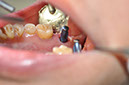 %_tempFileNameImplant%2039c%