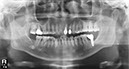 %_tempFileNameImplant%2039f%20(2)%