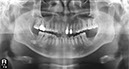%_tempFileNameImplant%2039f%