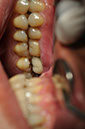 %_tempFileNameImplant%2039f2%