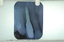 %_tempFileNameImplant%203c5%