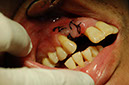 %_tempFileNameImplant%203e%
