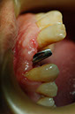 %_tempFileNameImplant%203k5%