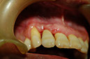 %_tempFileNameImplant%203ld%
