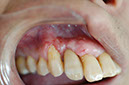 %_tempFileNameImplant%203le%
