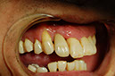 %_tempFileNameImplant%203m1%