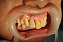%_tempFileNameImplant%203m2%