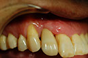 %_tempFileNameImplant%203m3%