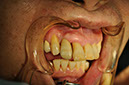%_tempFileNameImplant%203m4%