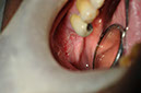 %_tempFileNameImplant%2040a2%