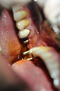 %_tempFileNameImplant%2040a3%