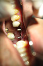 %_tempFileNameImplant%2040a5%