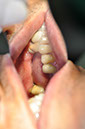 %_tempFileNameImplant%2040b1%
