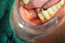 %_tempFileNameImplant%2040c1%