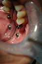 %_tempFileNameImplant%2040c3%