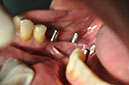 %_tempFileNameImplant%2040c7%
