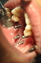 %_tempFileNameImplant%2040c8%