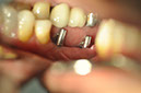%_tempFileNameImplant%2040c9%