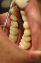 %_tempFileNameImplant%2040cb1%
