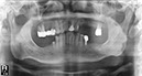 %_tempFileNameImplant%2040e1%