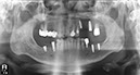 %_tempFileNameImplant%2040e2%