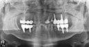 %_tempFileNameImplant%2040e3%