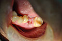 %_tempFileNameImplant%2044a%