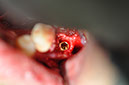 %_tempFileNameImplant%2044c%