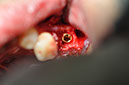 %_tempFileNameImplant%2044d%