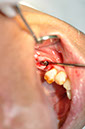 %_tempFileNameImplant%2044e%