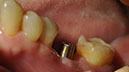 %_tempFileNameImplant%2044g%