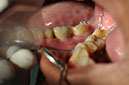 %_tempFileNameImplant%2044i%