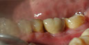 %_tempFileNameImplant%2044i2%