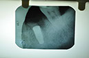 %_tempFileNameImplant%2044j2%