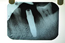 %_tempFileNameImplant%2044j3%