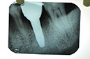 %_tempFileNameImplant%2044j4%