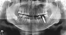 %_tempFileNameImplant%2044j5%