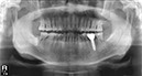 %_tempFileNameImplant%2044j6%