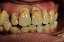 %_tempFileNameImplant%2045a1%