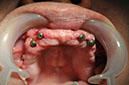 %_tempFileNameImplant%2045b1%