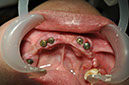 %_tempFileNameImplant%2045b2%