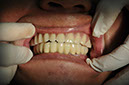 %_tempFileNameImplant%2045c1%