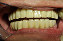 %_tempFileNameImplant%2045c2%