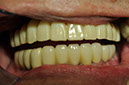 %_tempFileNameImplant%2045c3%