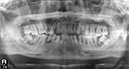 %_tempFileNameImplant%2045d1%
