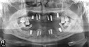 %_tempFileNameImplant%2045d2%