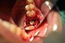 %_tempFileNameImplant%2048a5%