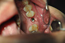 %_tempFileNameImplant%2048f3%