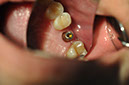 %_tempFileNameImplant%2048f6%
