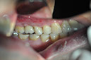 %_tempFileNameImplant%2048g2%